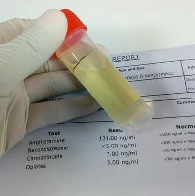 Hand resting on drug test report and holding clear tube with red top and amber fluid inside