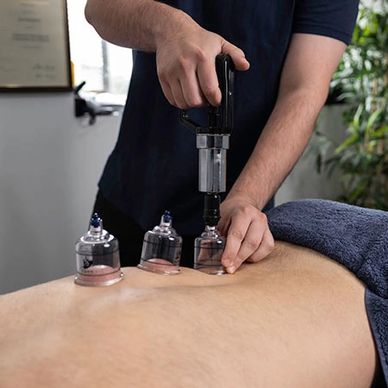 Cupping Treatment