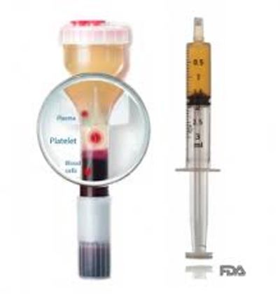 Platelet Rich Plasma to stimulate collagen, tighten skin, diminish fine lines/pore size.