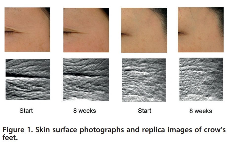 astaxanthin effects on skin