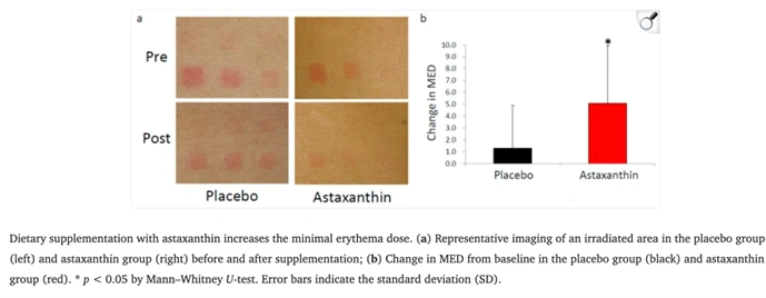 astaxanthin for skin protection