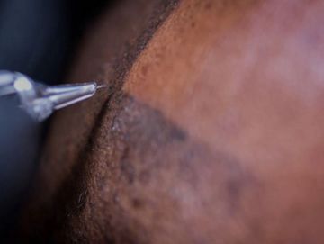 Scalp micropigmentation Tattoe hair loss treatment 