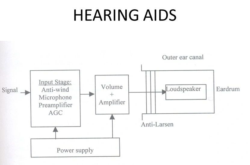 digital hearing aids diagram