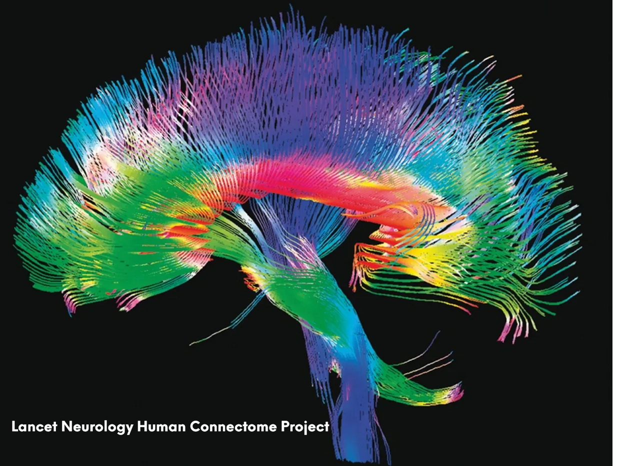 Lancet Neurology Human Connectome Project
