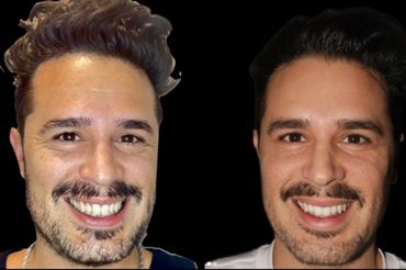 Two men smiling against a black background.