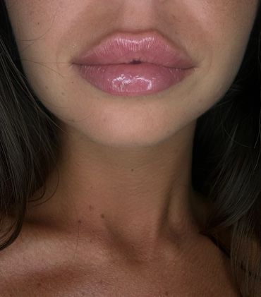Close-up of glossy lips and part of a woman's neck.