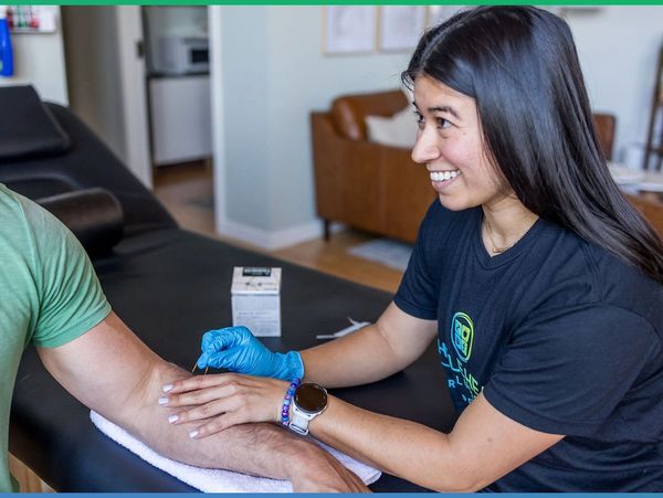 dry needling