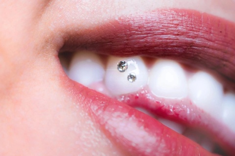 Smiles Renew Whitening Solutions
