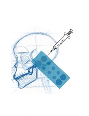 Illustration of a syringe targeting a human skull's brain area.