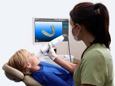 Digital scanning instead of impressions for fabricating of dental crowns and bridges. 