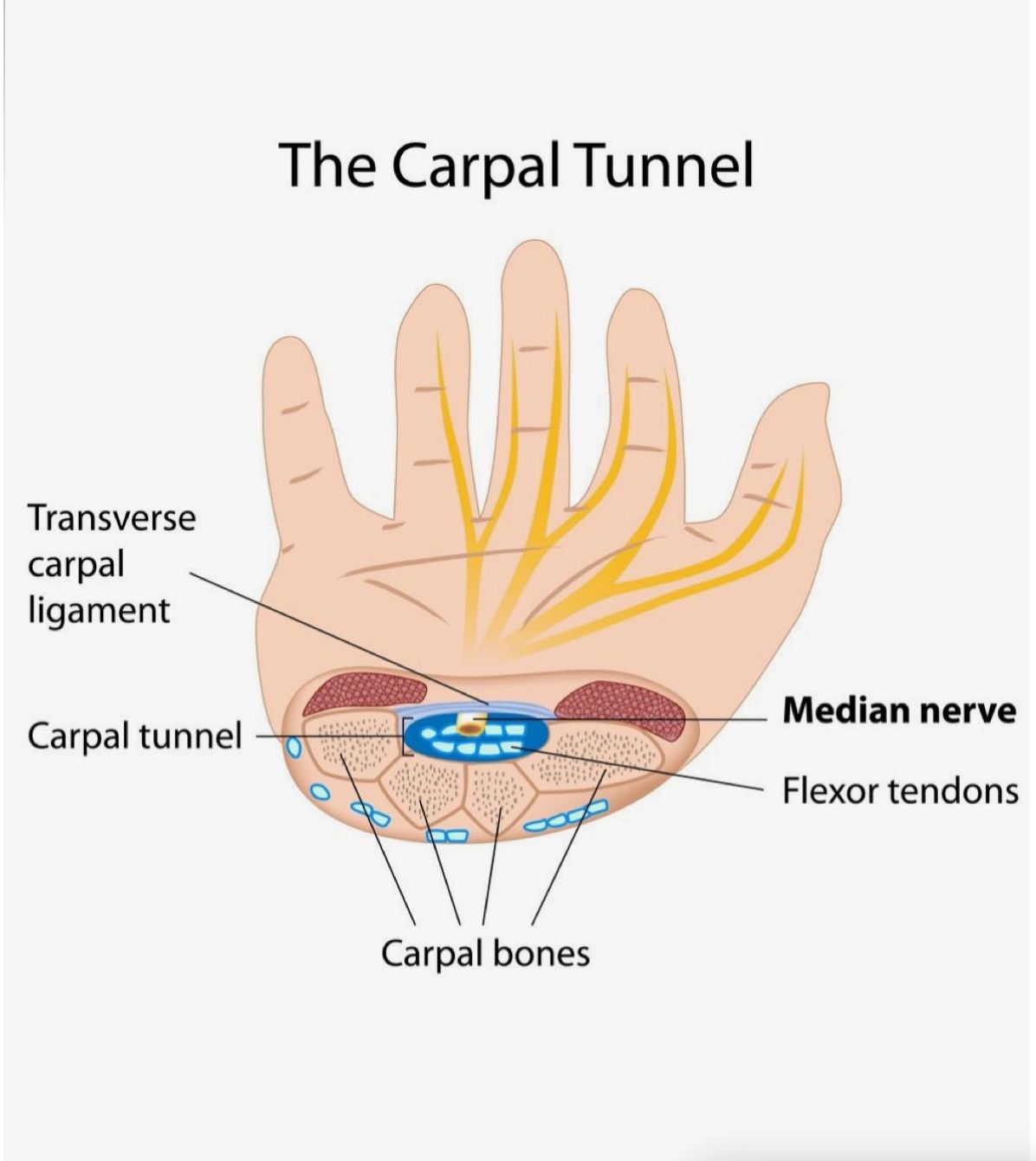 Tinel Sign. Carpal Tunnel Test Procedure & Results [K3XVIE]