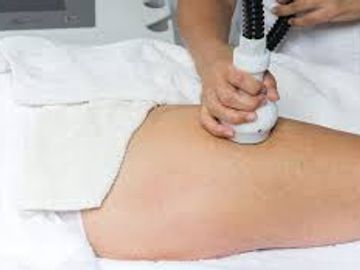 Cryo body contouring