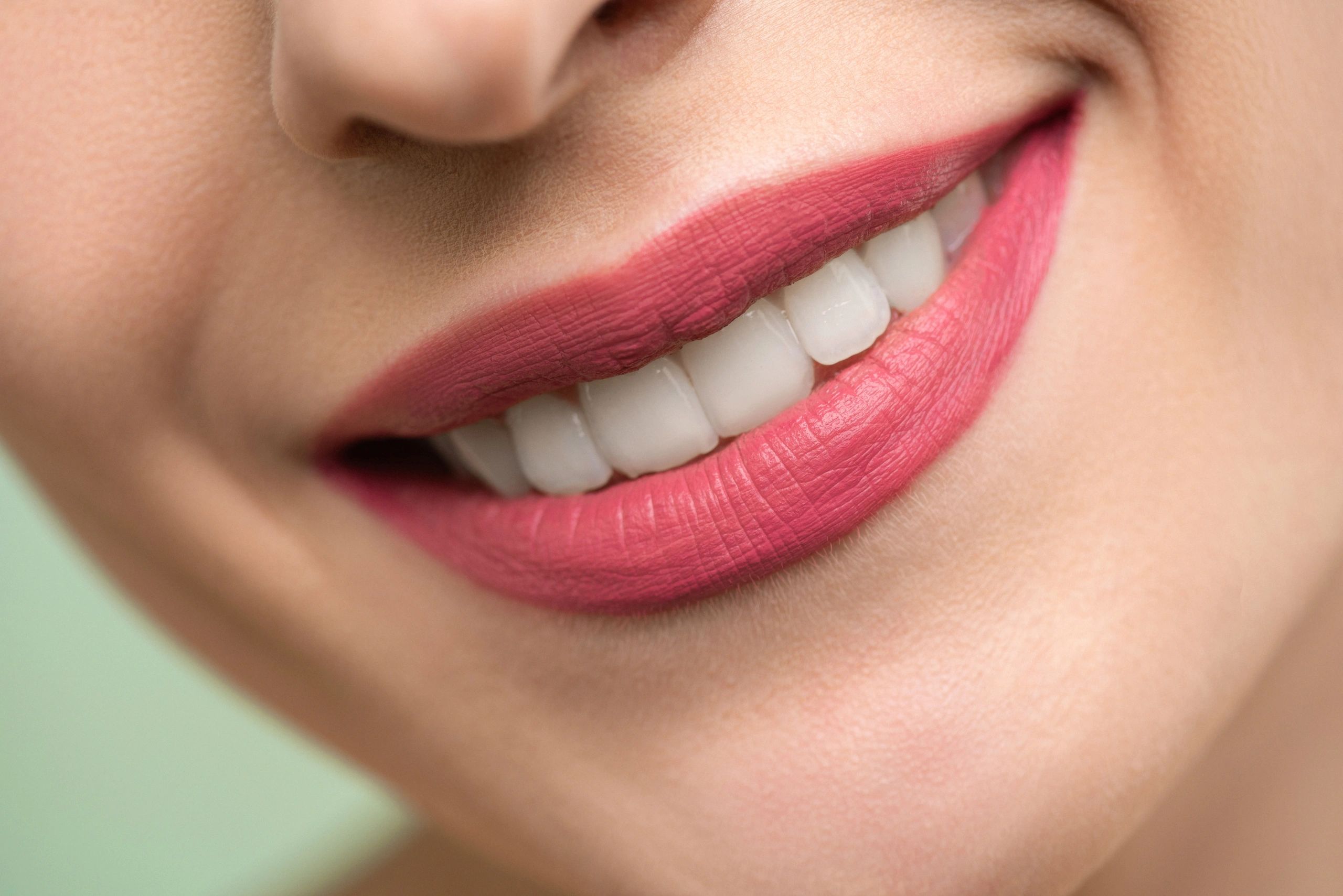 Sonrisa blanqueamiento dental dientes blancos