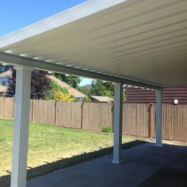 V-pan Cover Pergola Wrap Columns Kent WA