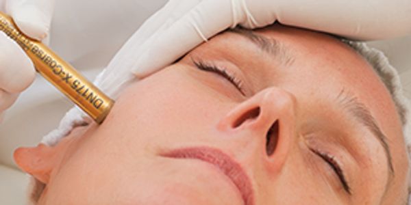 Pure Aesthetica Microdermabrasion
