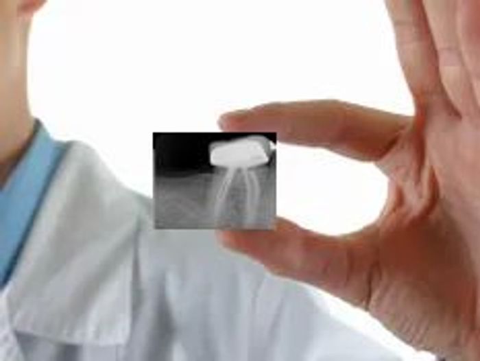 North Central Florida Endodontics Endodontist, Root Canal