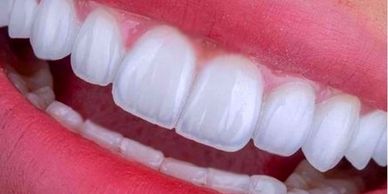 Close-up of bright, white teeth and pink lips.