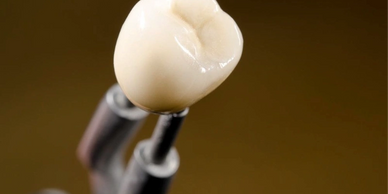 Close-up of a dental crown held by a dental tool.