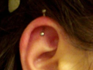 Helix piercing through the top arc of the ear