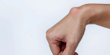 Hand bent backward at the wrist in an unusual position.