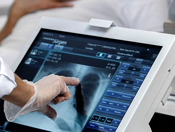 Doctor examining a chest X-ray on a digital screen.