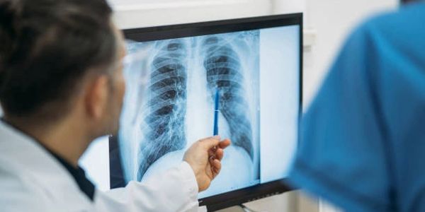 Doctor analyzing a chest X-ray on a screen, pointing with a pen.
