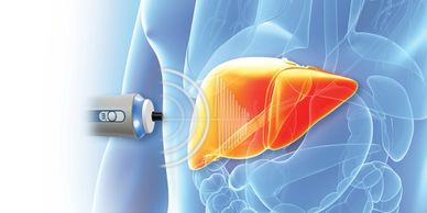 Fibroscan machine testing a liver for diseases