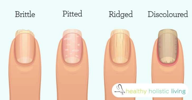 This is What Your Fingernails Are Warning You About