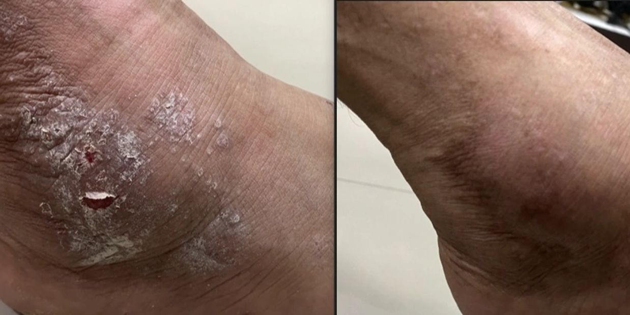 Dr. Kuldeep Bhardwaj, Dermatologist in Jabalpur providing skin eczema and dermatitis treatment