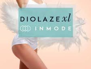 DiolazeXL InMode hair removal treatment advertisement.