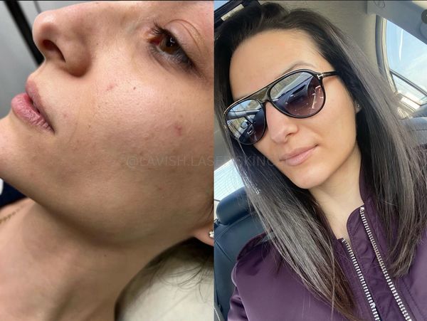 Before and after pictures of women