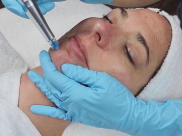 woman getting platinum nano facial