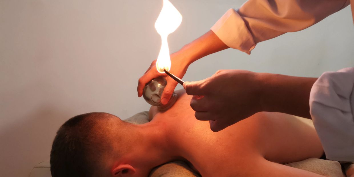 Two Tan Wellness- Fire Cupping therapy：Rejuvenate Cupping, Relaxing Cupping。
火罐疗法-排毒拔罐法-安神拔罐法