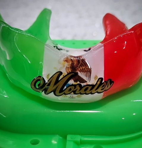 A custom mouthguard for mexican pride and heritage