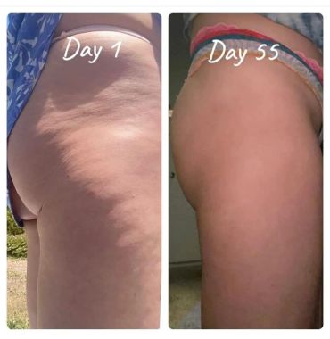 Comparison of thigh skin texture from day 1 to day 55.