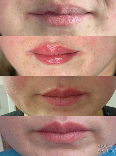 Process of permanent lip color