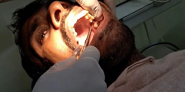 Surgical Extraction