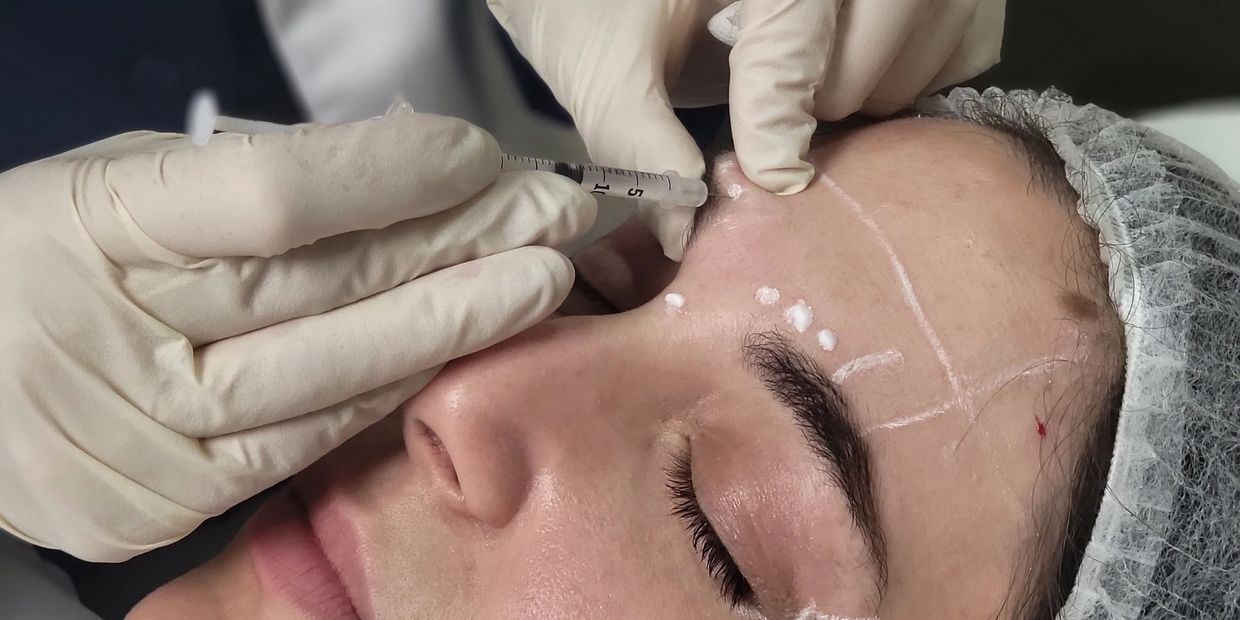 Serviço de Botox na Pure Senses, clínica localizada na zona da Boavista, no Porto