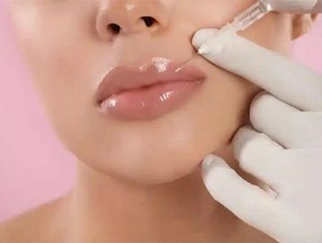 A close-up of a woman receiving a cosmetic lip injection.