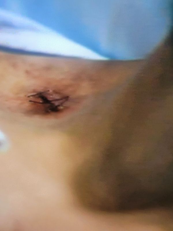 
East New York S 1
CBS