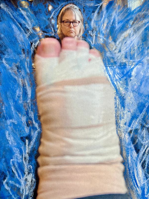Self portrait of me in mirror looking over my bandaged toes, Lymphedema art
multimedia collage
