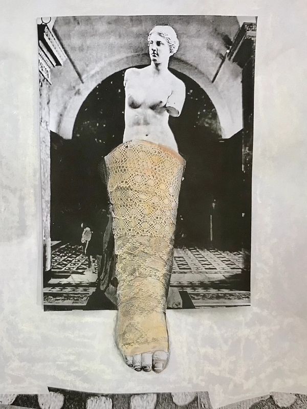 Multimedia art collage of lace wrapped lymphedema bandage. Considering definitions of beauty.