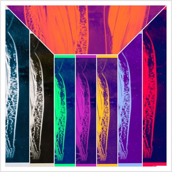 Digital art collage from my leg's MRI imagery (made in the Lymphedema research lab at Vanderbilt