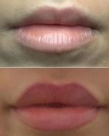 Full lip colour tattoo