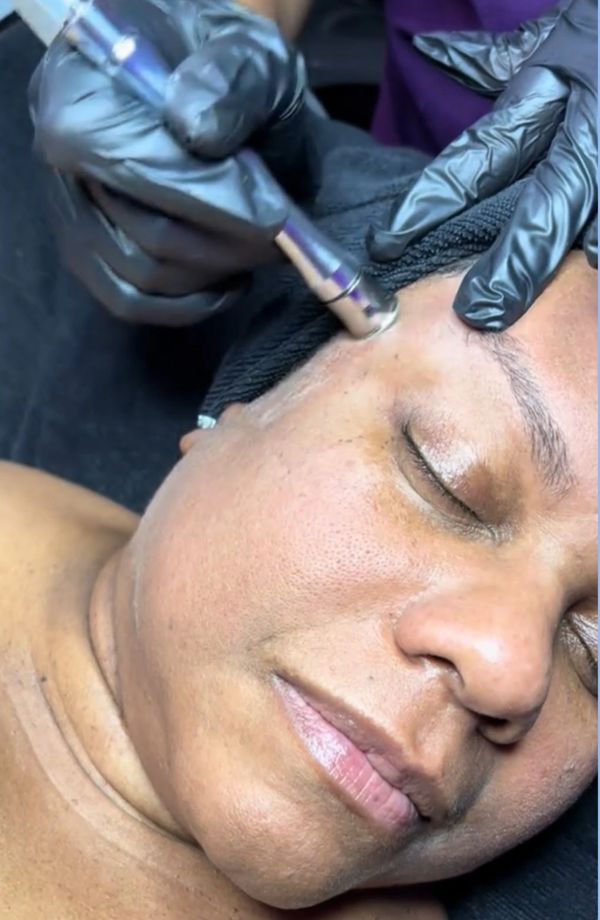 Deep exfoliation - deep cleansing 