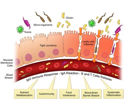 How your gut lining acts when leaky gut is present.