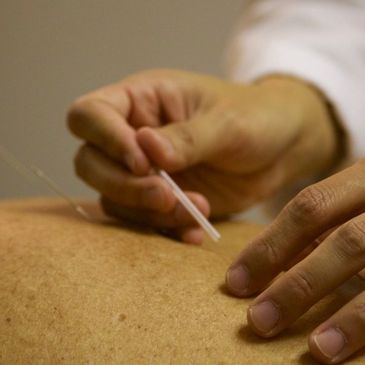 Kind Acupuncture and Holistic Medicine for arthritis, allergies, acne,  chronic pain to sprains, 