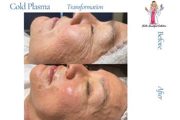 Cold Plasma before and after picture