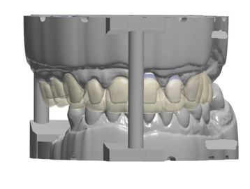 Temp. Shell Designs