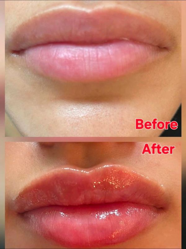 Comparison of natural and glossy lips.